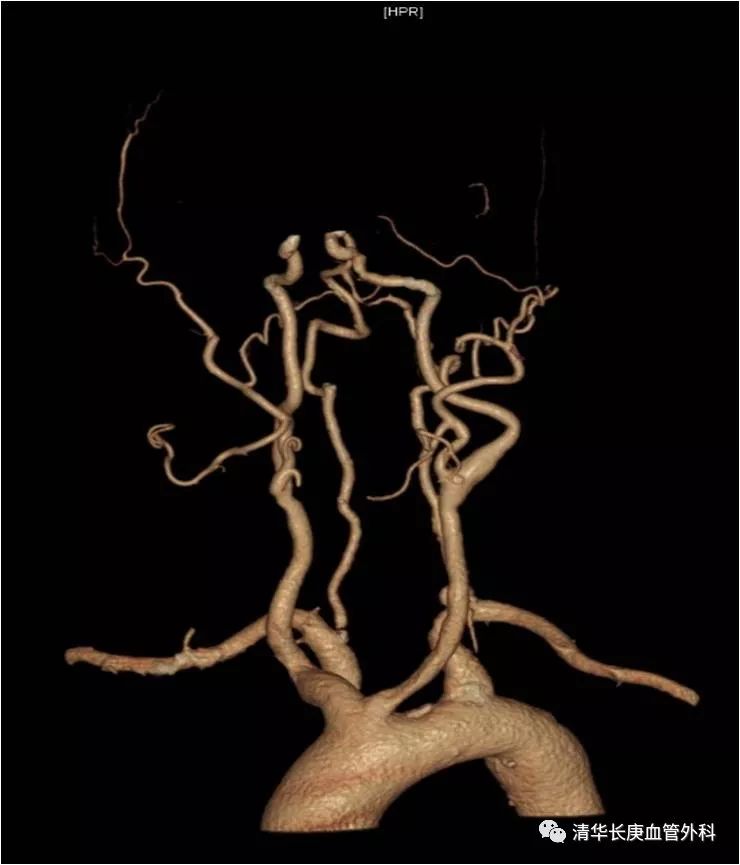 教学相长共同成长,北京清华长庚医院周围血管外科