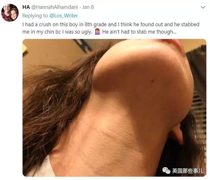 熊孩子拿铅笔扎同学,是不是每个中国小孩都被铅笔扎过