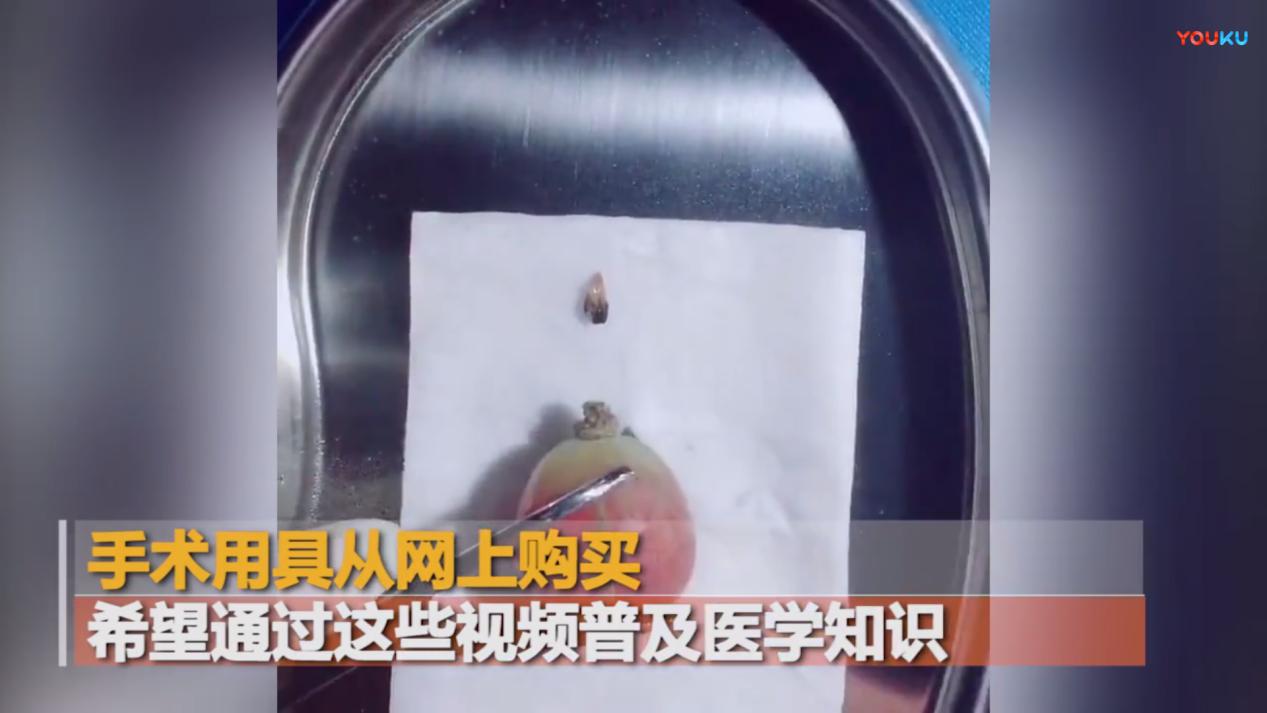 来者不拒！外科医生竟拿它们来练手