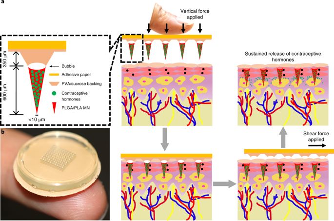 避孕贴可以长期使用吗,长期贴避孕贴有没有副作用及禁忌