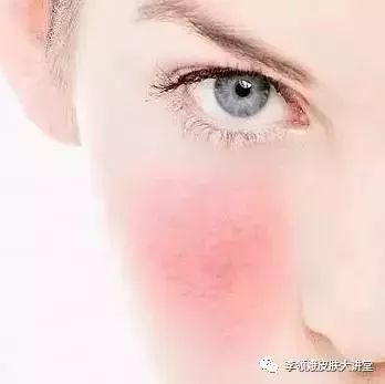 杏林微科普帮您认识各类头晕,杏林微科普冬季手足皲裂了解一下