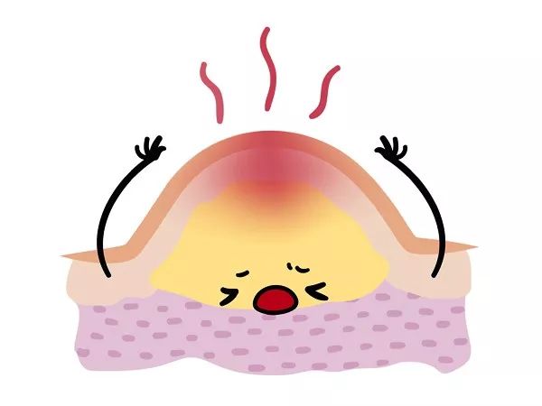 春节胡吃海喝怎么办,过年大吃大喝长痘