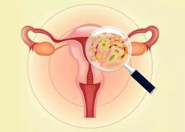 3周岁女宝宝外阴炎,得了阴道炎要去看医生吗