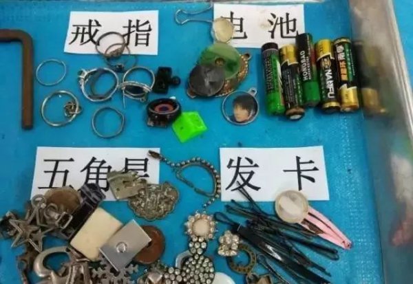 妈妈给孩子换尿布发现嘴里一个洞,儿童换尿布时吞耳环