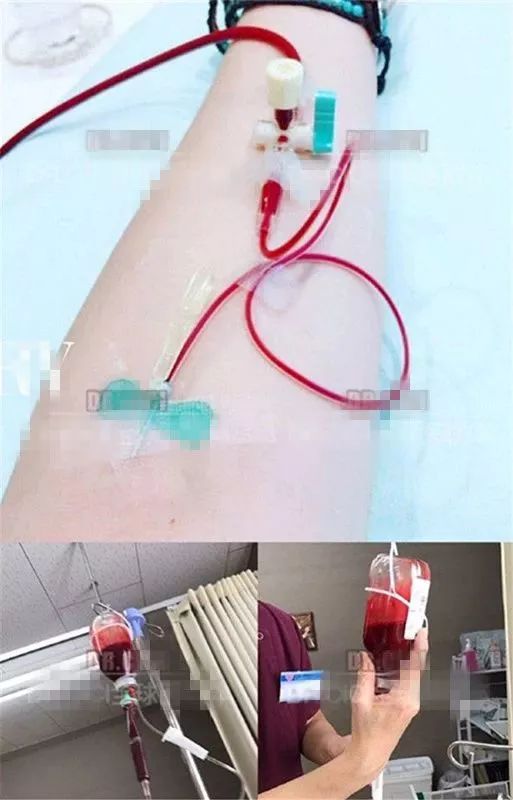 跟着明星吃胶原蛋白,跟着明星吃一天体重会有什么变化