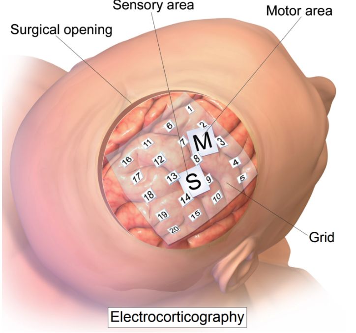 讲点硬科技：“脑子借你用用”，什么时候能实现？