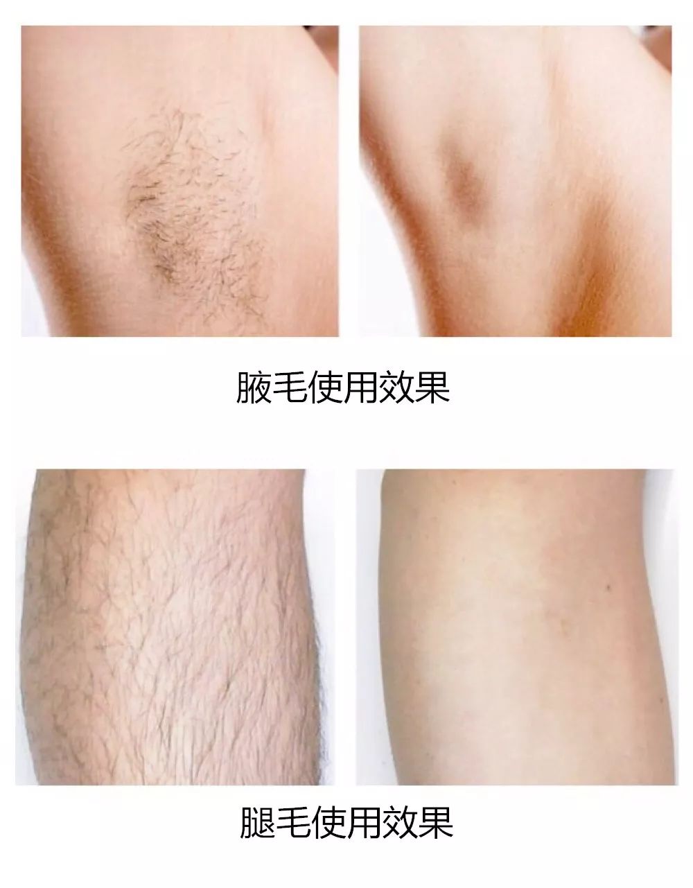 閫傚悎瀛︾敓鍏氱殑鍘昏吙姣涜啅,濂界敤鐨勮劚鍞囪劚姣涜啅鎺ㄨ崘