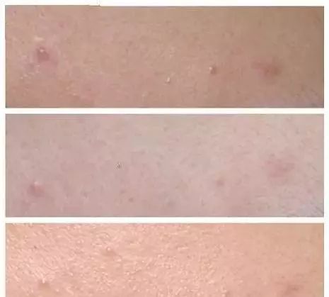 柚子卸妆啫喱优惠,柚子卸妆啫喱小样