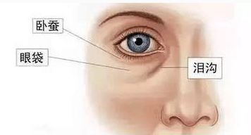 眼部微创双眼皮手术的护理,眼部画法教程