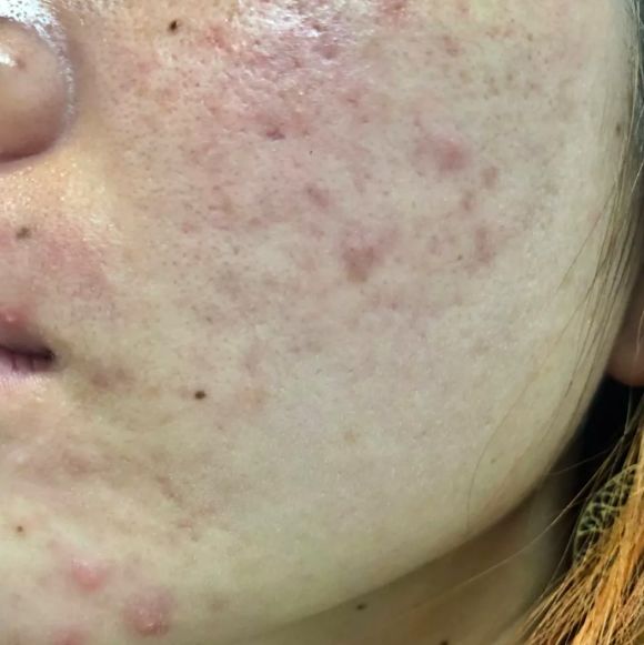 日本保湿清洁洗面奶,日本火山灰樱花洗面奶