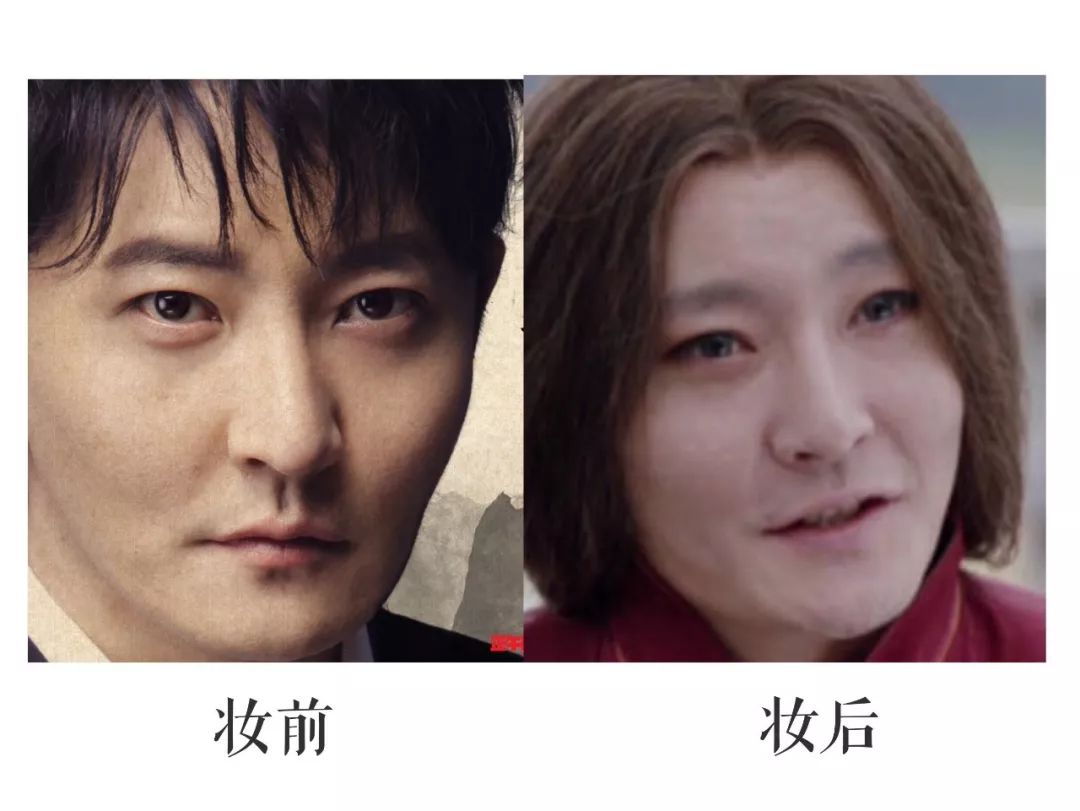 美容针真的可以祛法令纹吗,10块钱不到的成本去法令纹去皱