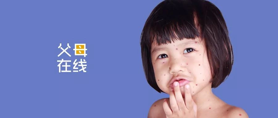 一片红痘,孩子长痘家长们一定要重视起来