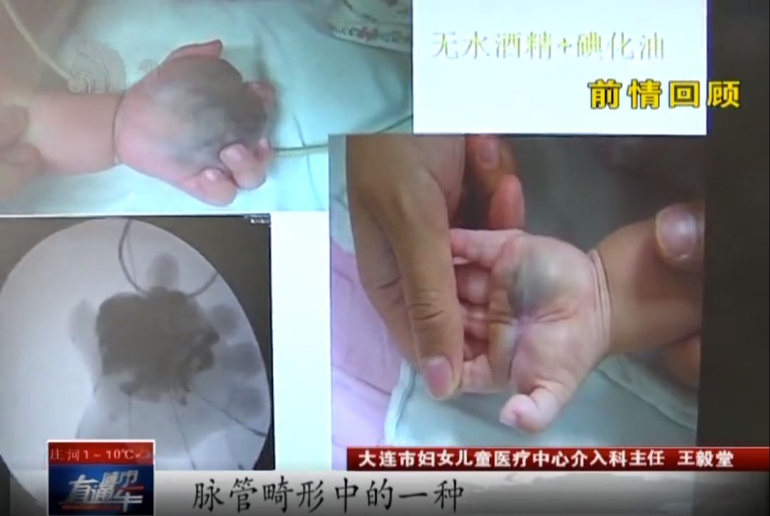 帮忙大小王|留守儿童手肿像水球大王帮忙查明病因