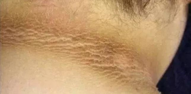 孩子脖子很黑洗不掉是怎么回事,孩子脖子黑洗不下去