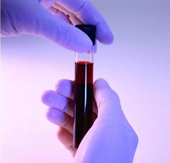 张雨绮猪油抹脸,张雨绮猪油膏