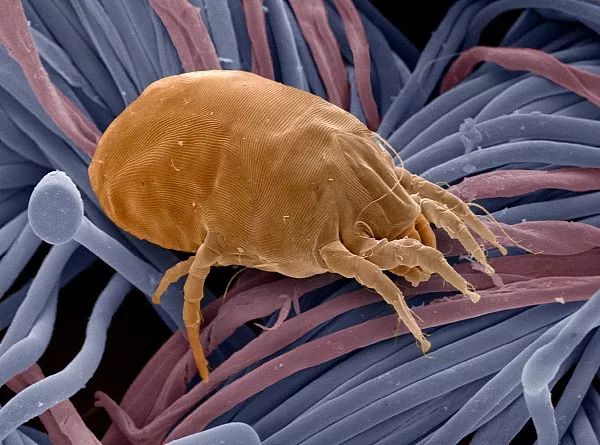 尘螨患者的自述,关于尘螨的亲历