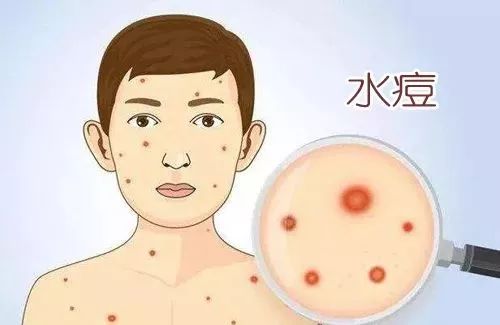 家长注意这种传染病已进入高发期,家长注意近期这两种疾病高发