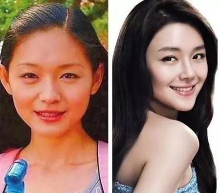 深扒美白成分不可不知的烟酰胺,市面的美白针