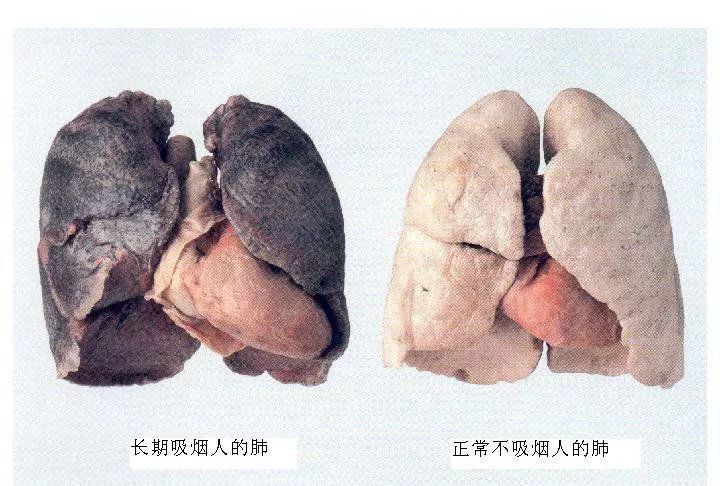 健康随烟而逝病痛伴烟而生,健康随缘而逝病痛伴烟而生