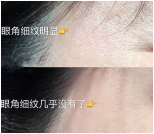 抗皱抗衰澳洲,大牌抗衰淡斑护肤品