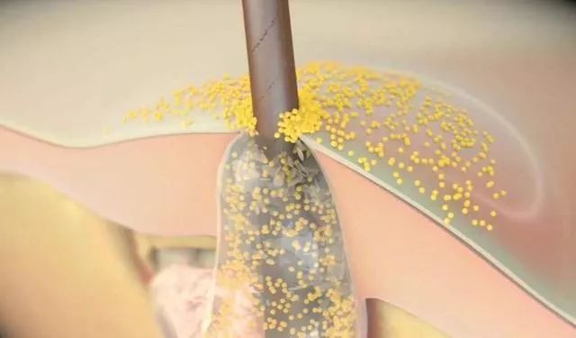 新西兰高端沙龙专用，2秒1喷，增发从“根”开始