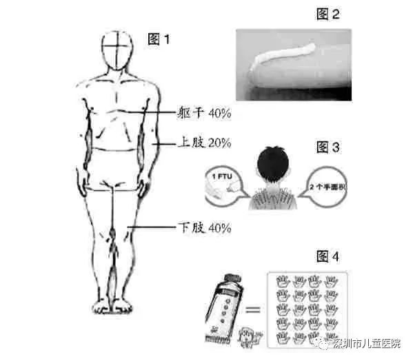 耳朵湿疹为什么反复发作,手湿疹反复发作如何除根