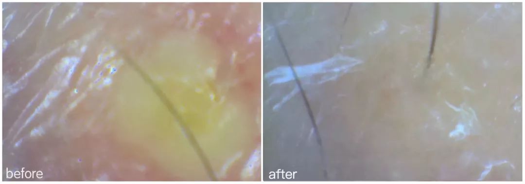 灏忚寕鑲岃瘖瀹ゅ埌搴曟湁澶氬己,灏忚寕鑲岃瘖瀹よˉ姘村悧