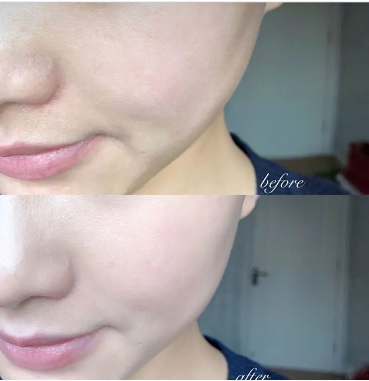 现在最火的气垫有哪些牌子,大牌气垫推荐公认好用第一名