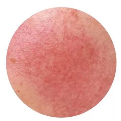 盲测14天揭密|年轻肌特训营收关，那瓶好评如潮的精华水究竟是谁？