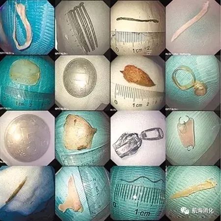 一定要收藏鱼刺卡喉咙的方法,收藏鱼骨怎么处理