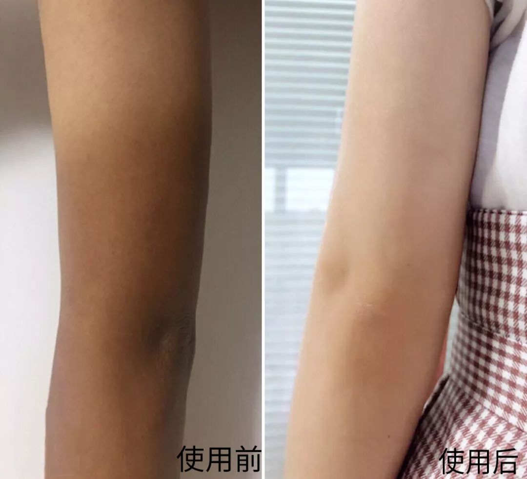 裸感美腿|1瓶=20双*袜丝**！3秒喷出“裸感”大美腿！隐形毛孔、鸡皮肤！短裙绝配