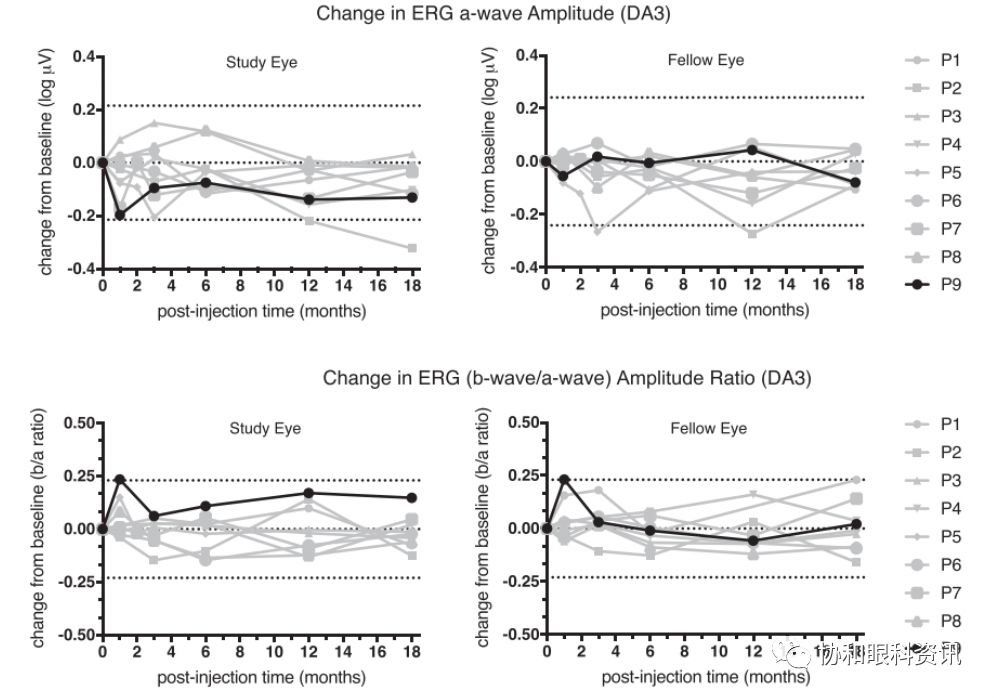 文摘速递丨X-连锁视网膜劈裂基因治疗的I/IIa期临床试验