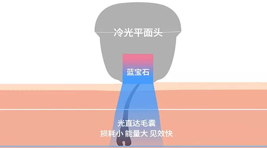 脱毛疼得哭,脱毛疼的撕心裂肺
