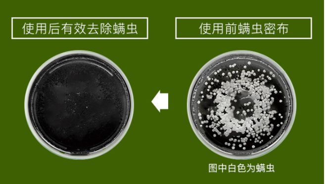 头皮除螨虫神器哪种好用,除头螨头屑小窍门