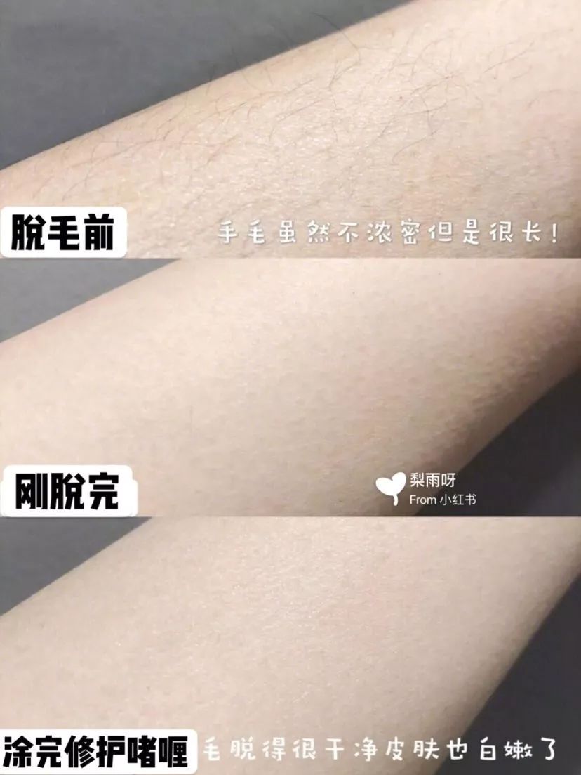 春天不脱毛,春天不脱毛夏天怎么穿短裙