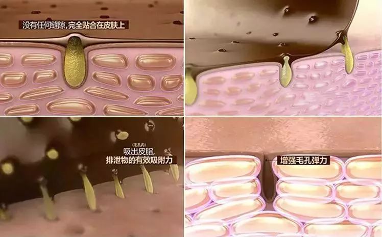 怎么把脸上的黑头清掉,去黑头推荐全脸