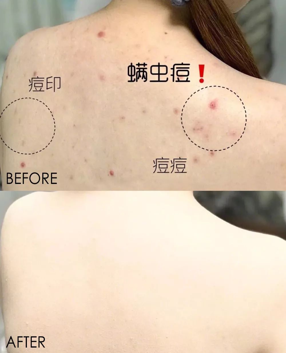 皮肤清洁出黑色的东西,皮肤挤出白色膏状很臭怎么办