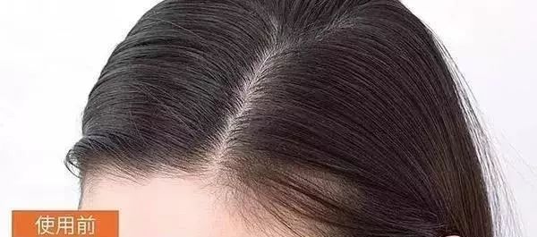 蓬松神器让头发立马蓬松,头发蓬松神器顶发根