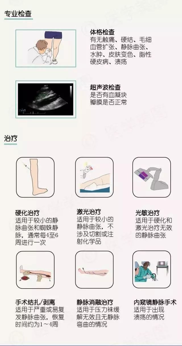 关于静脉曲张你知道多少?多图带你深入了解静脉曲张!