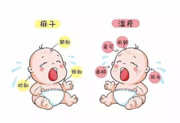 中暑应急处置措施有哪些内容,中暑怎么办这些急救方法了解一下