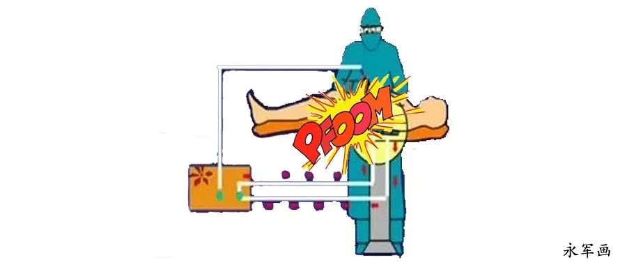 器官爆炸的威力有多大,能量外科是做什么的