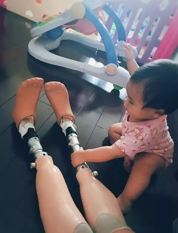 她地震中失去双腿,她在汶川地震失去双腿及女儿