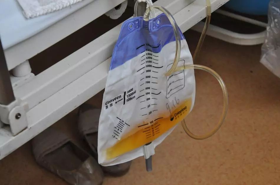 老年女性导尿常见问题,老年女性插导尿管的正确方法