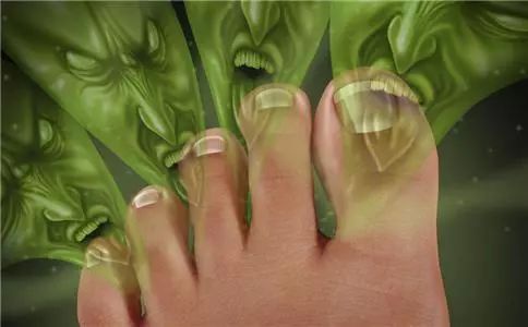 蚊虫叮咬脚气怎么办,超好用的止痒消肿的药膏蚊虫叮咬