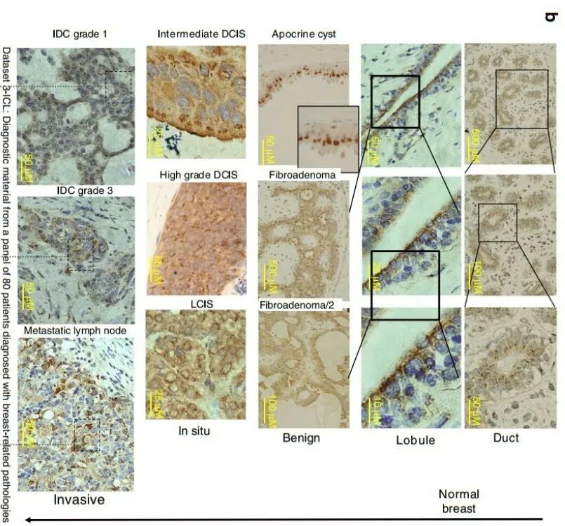 nature子刊癌症新突破,nature子刊影响因子