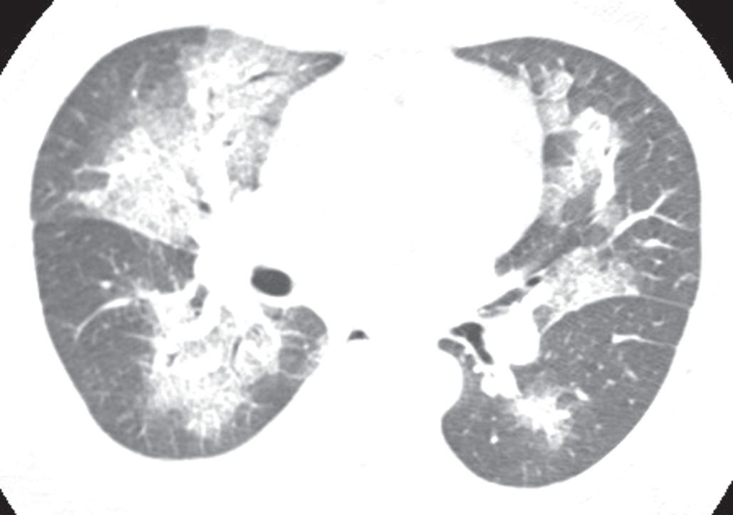 认识肺部的目的,认识呼吸器官知识点