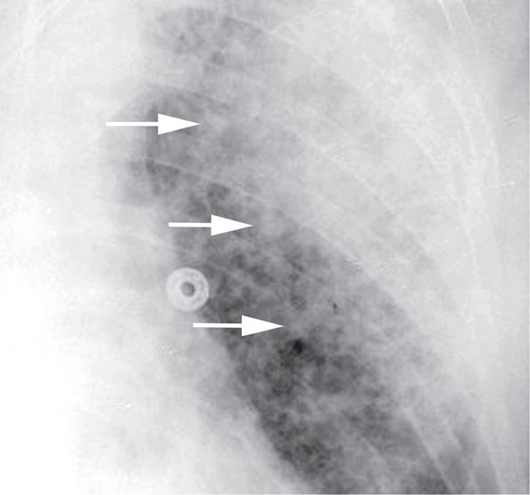 认识肺部的目的,认识呼吸器官知识点