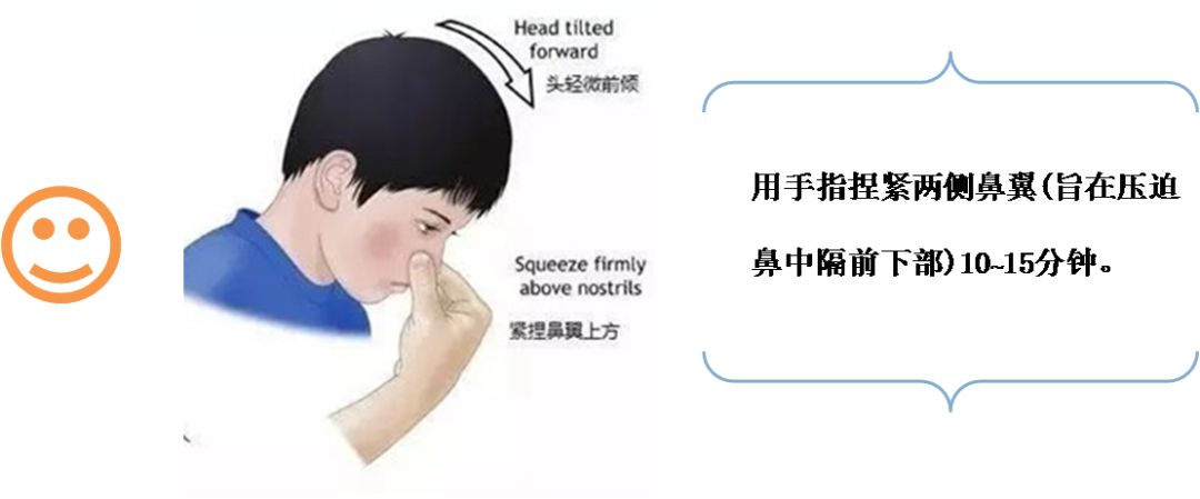 鼻出血的六种止血方法,鼻出血的止血方法你做对了吗