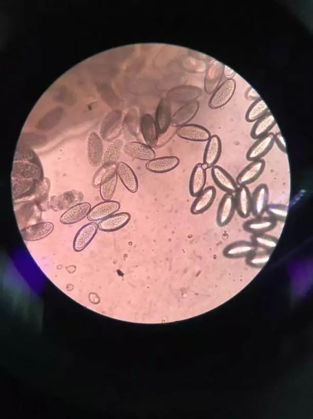 四岁女宝宝说小便地方痒用什么药,四岁女宝宝说小便地方痒怎么治疗