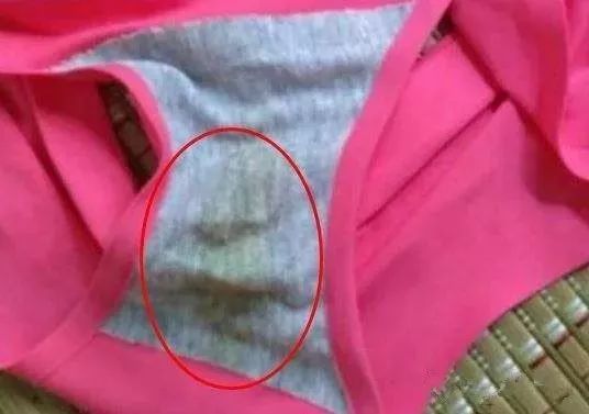 女性裤子裆部有异味怎么办,无痕裤内裆
